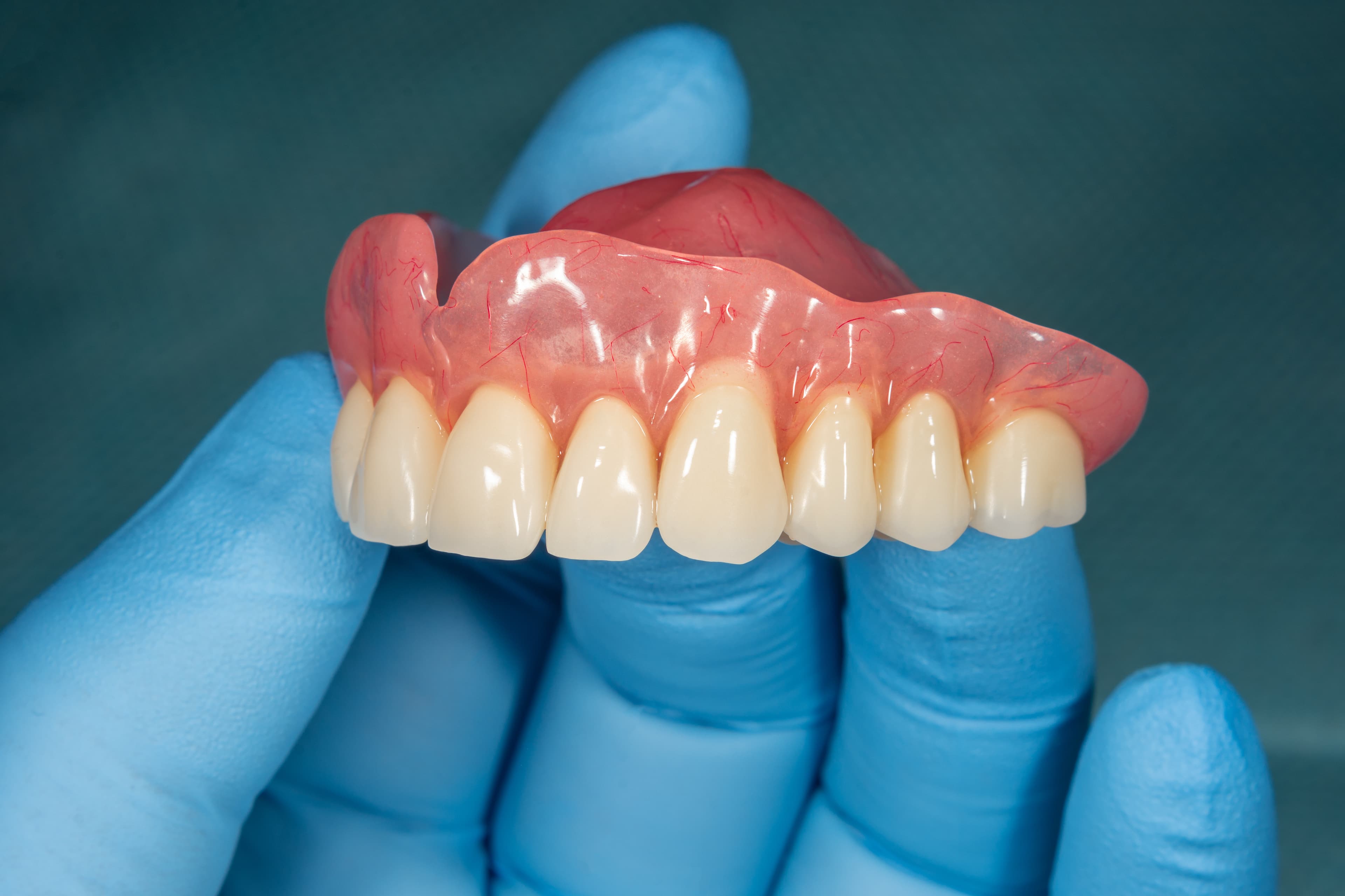 Prótesis dentales