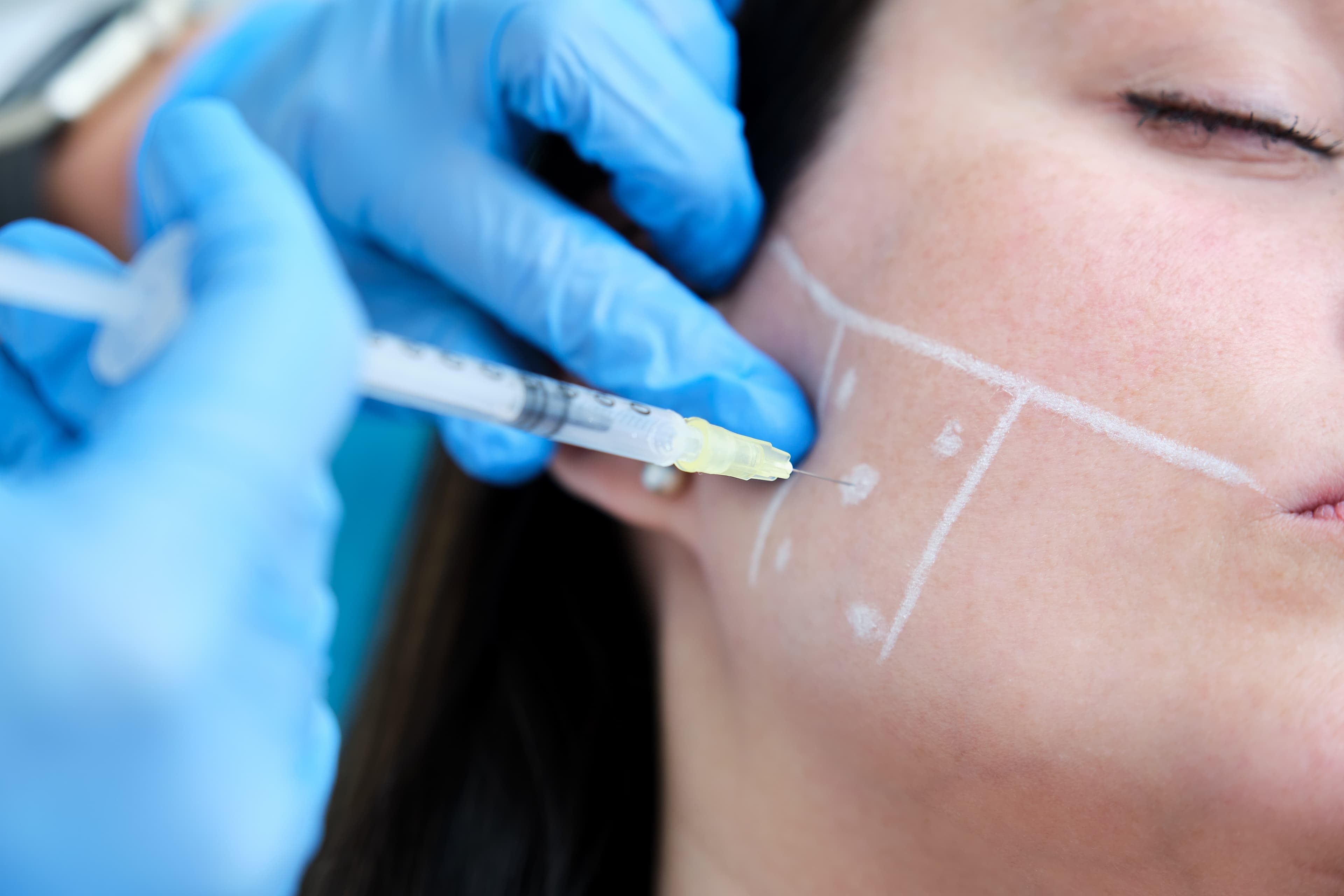 Estética facial