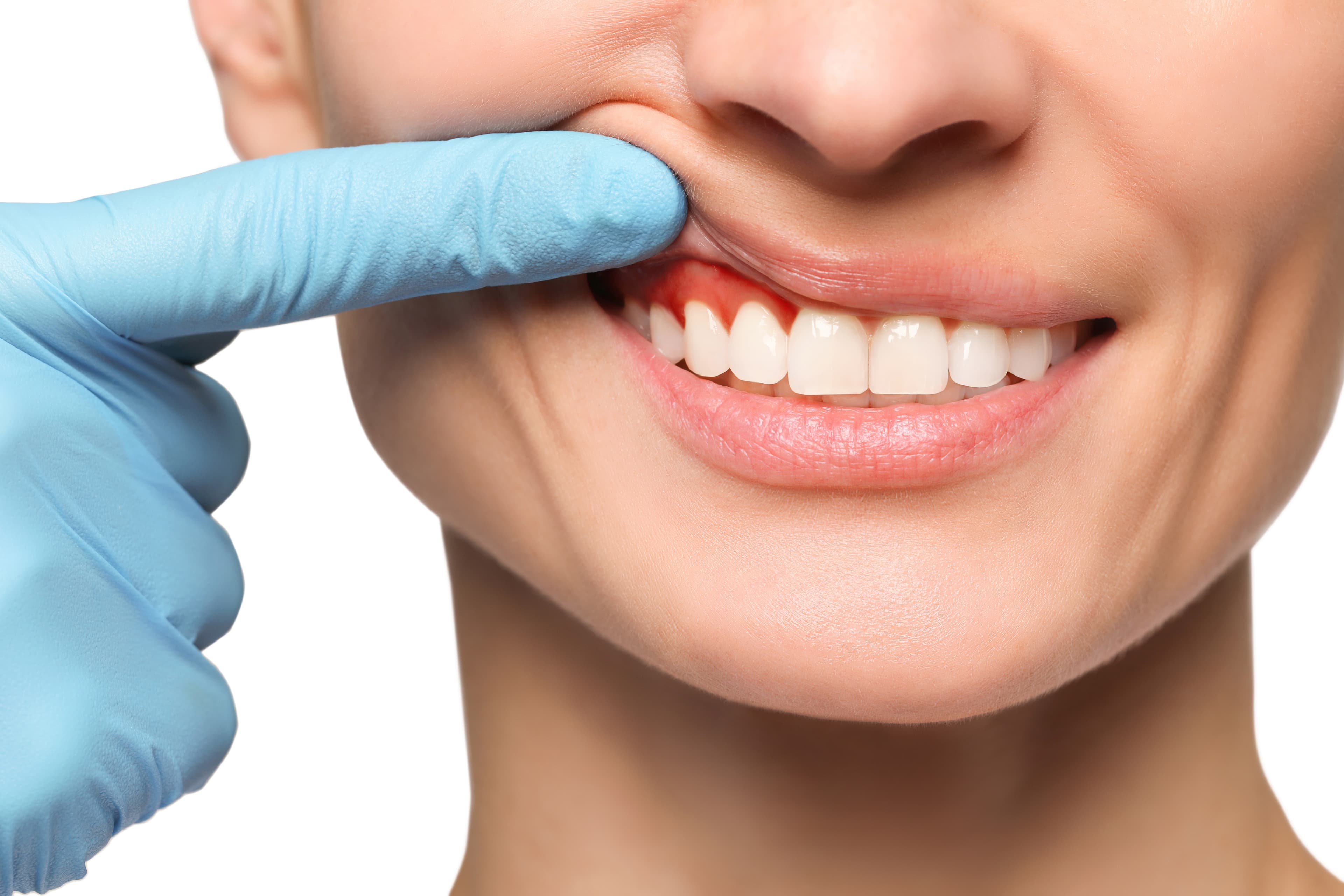 Periodoncia